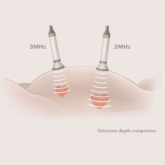 2MHz vs 3MHz fetal doppler comparison showing deeper penetration and more consistent signal with 2MHz