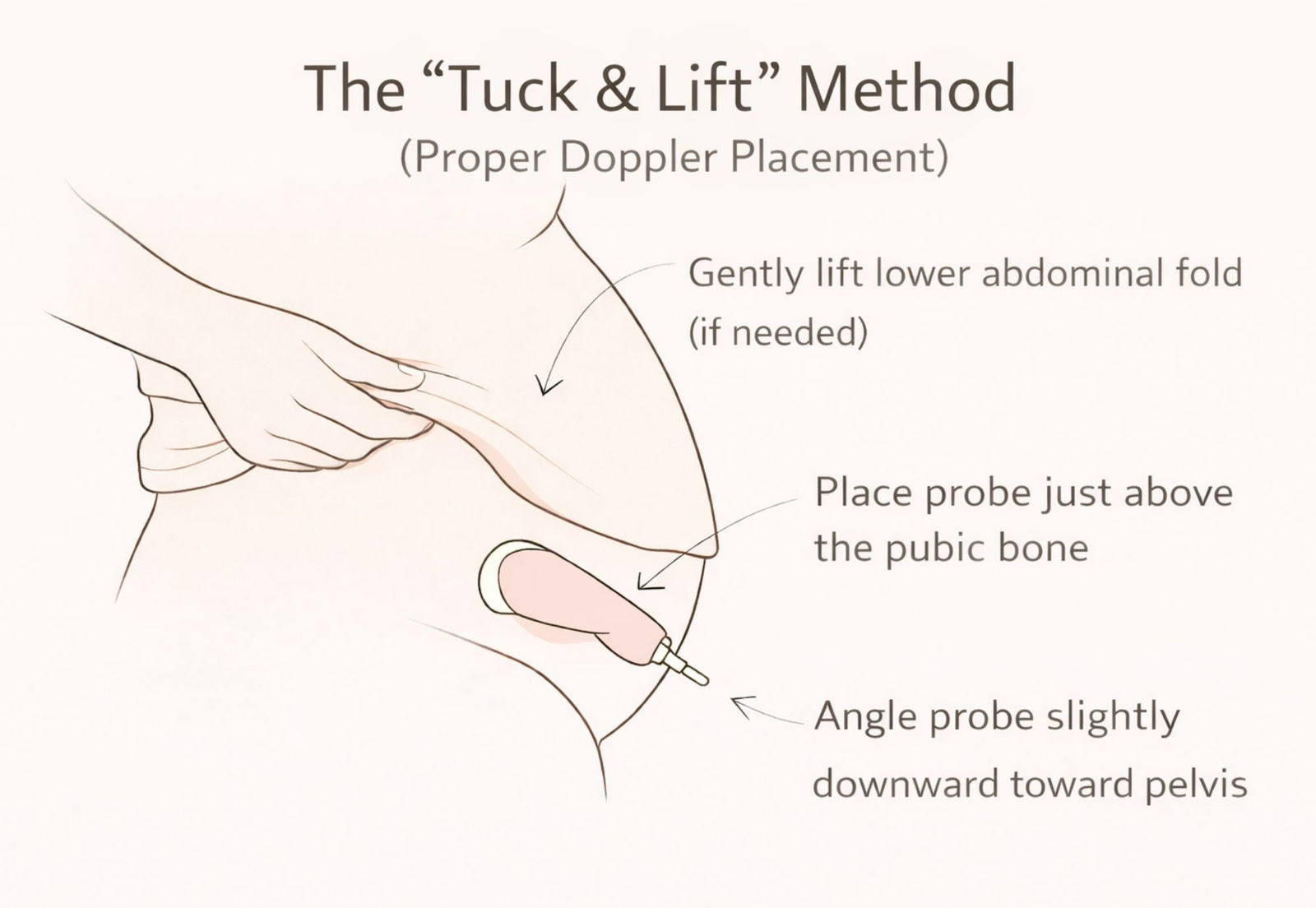 tuck and lift method fetal doppler placement lower abdomen diagram