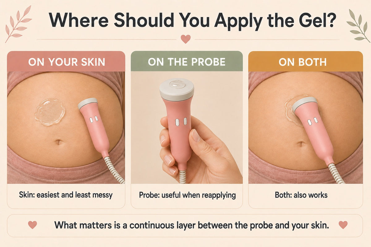 Infographic showing where to apply ultrasound gel for a fetal doppler — on your skin, on the probe, or on both